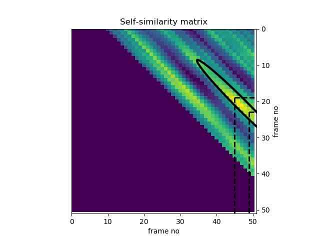 Audio Segmentation Thumbnail (Source: iNNovationMerge)